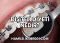 Diş Teli Diyeti Nedir?