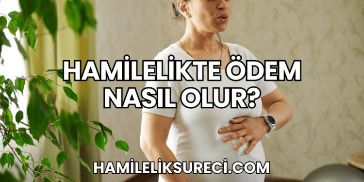 Hamilelikte Ödem Nasıl Olur?