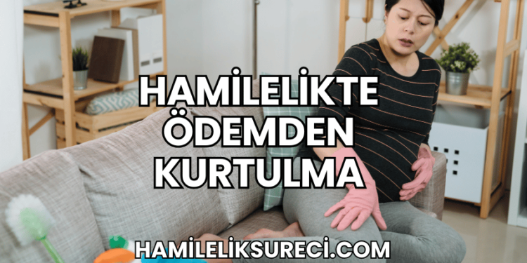 Hamilelikte Ödemden Kurtulma