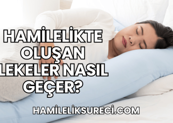 Hamilelikte Oluşan Lekeler Nasıl Geçer?