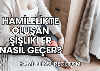 Hamilelikte Oluşan Şişlikler Nasıl Geçer?