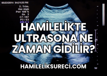 Hamilelikte Ultrasona Ne Zaman Gidilir?