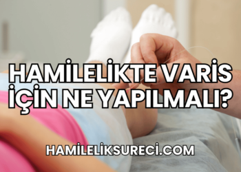Hamilelikte Varis İçin Ne Yapılmalı?