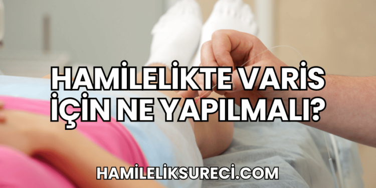 Hamilelikte Varis İçin Ne Yapılmalı?