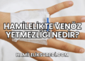 Hamilelikte Venöz Yetmezliği Nedir?