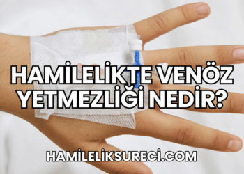 Hamilelikte Venöz Yetmezliği Nedir?
