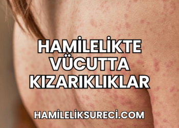 Hamilelikte Vücutta Kızarıklıklar