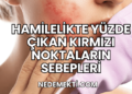 Hamilelikte Yüzde Çıkan Kırmızı Noktaların Sebepleri