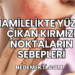 Hamilelikte Yüzde Çıkan Kırmızı Noktaların Sebepleri