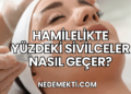 Hamilelikte Yüzdeki Sivilceler Nasıl Geçer?