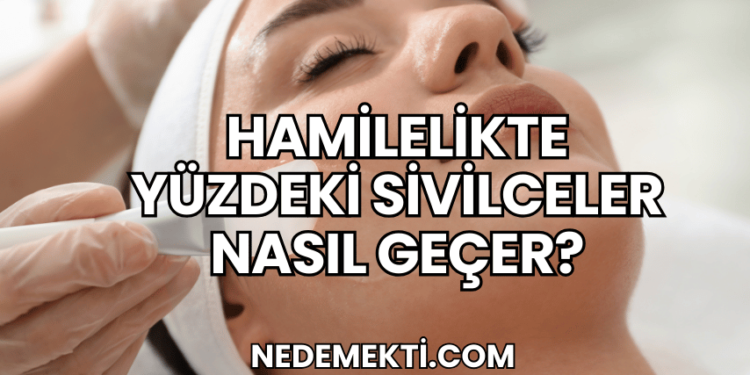 Hamilelikte Yüzdeki Sivilceler Nasıl Geçer?
