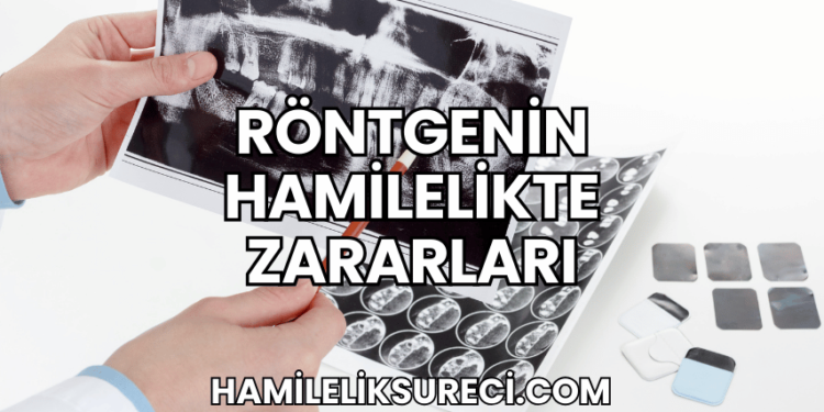 Röntgenin Hamilelikte Zararları