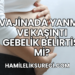 Vajinada Yanma ve Kaşıntı Gebelik Belirtisi Mi?