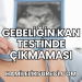 Gebeliğin Kan Testinde Çıkmaması