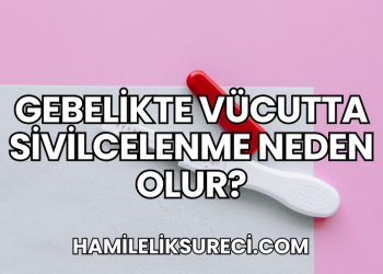 Gebelikte Vücutta Sivilcelenme Neden Olur?