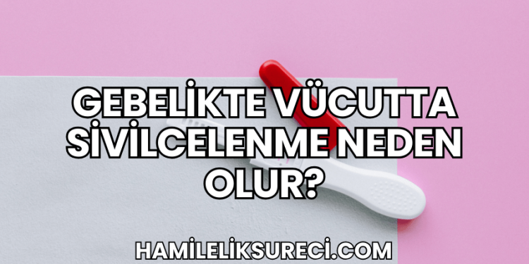 Gebelikte Vücutta Sivilcelenme Neden Olur?