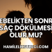 Gebelikten Sonra Saç Dökülmesi Olur mu?