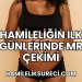 Hamileliğin İlk Günlerinde MR Çekimi