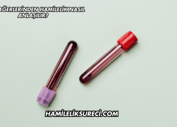 Kan Değerlerinden Hamilelik Nasıl Anlaşılır?