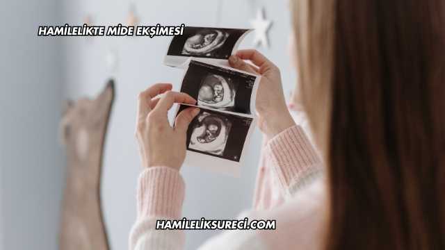 Hamilelikte Mide Ekşimesi