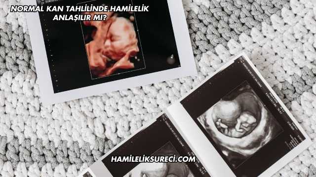 Normal Kan Tahlilinde Hamilelik Anlaşılır mı?