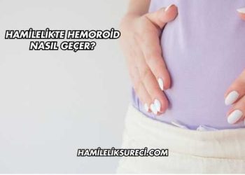 Hamilelikte Hemoroid Nasıl Geçer?