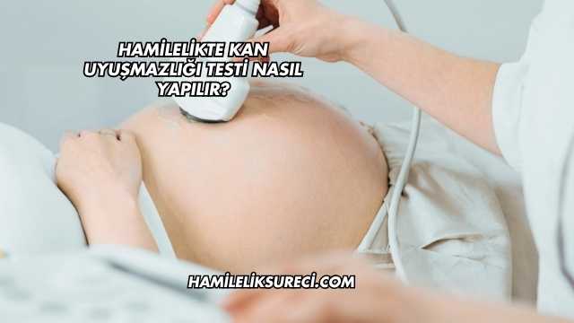 Hamilelikte Kan Uyuşmazlığı Testi Nasıl Yapılır?
