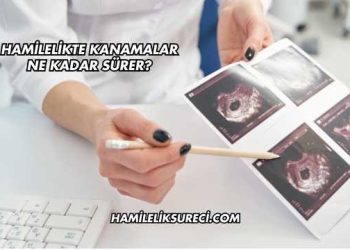 Hamilelikte Kanamalar Ne Kadar Sürer?