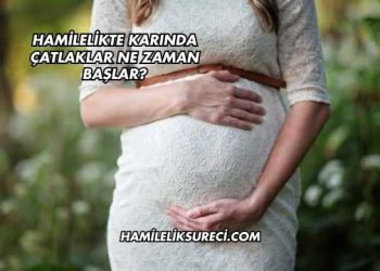 Hamilelikte Karında Çatlaklar Ne Zaman Başlar?