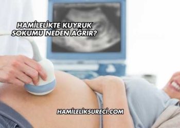Hamilelikte Kuyruk Sokumu Neden Ağrır?