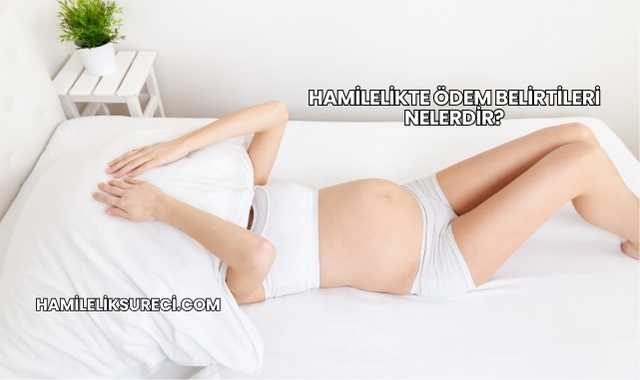 Hamilelikte Ödem Belirtileri Nelerdir?