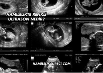 Hamilelikte Renkli Ultrason Nedir?