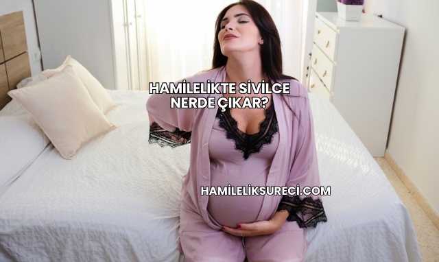 Hamilelikte Sivilce Nerde Çıkar?