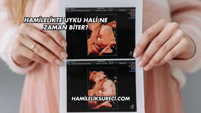 Hamilelikte Uyku Hali Ne Zaman Biter?