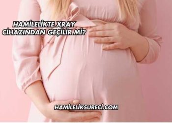 Hamilelikte Xray Cihazından Geçilir mi?