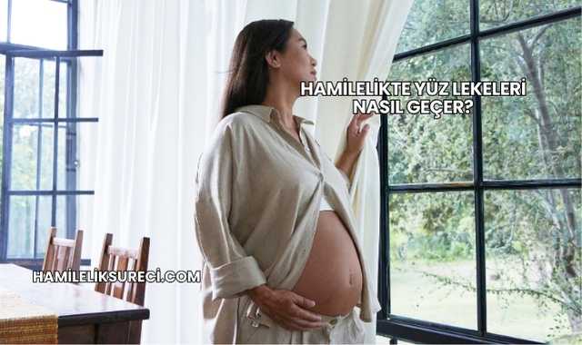 Hamilelikte Yüz Lekeleri Nasıl Geçer?