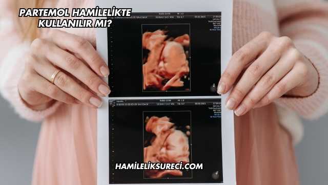 Partemol Hamilelikte Kullanılır mı?