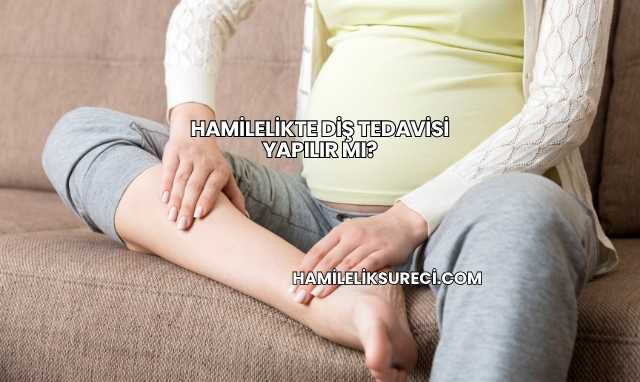 Hamilelikte Diş Tedavisi Yapılır mı?