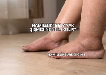 Hamilelikte El Ayak Şişmesine Ne İyi Gelir?