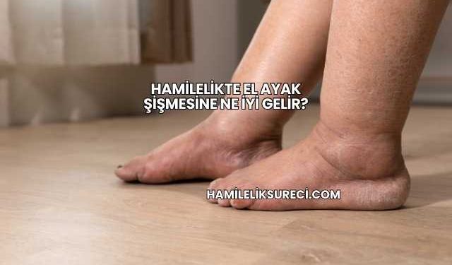 Hamilelikte El Ayak Şişmesine Ne İyi Gelir?