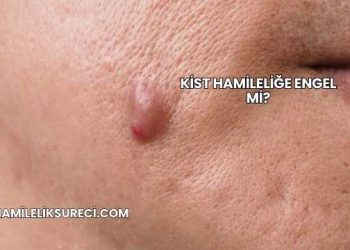 Kist Hamileliğe Engel mi?