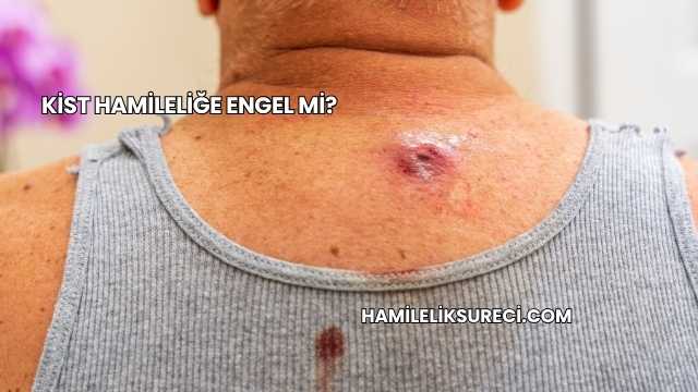 Kist Hamileliğe Engel mi?