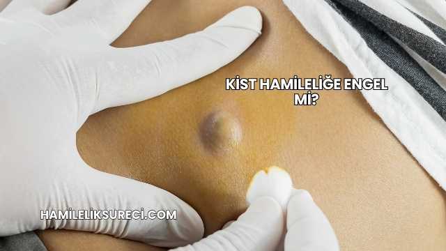 Kist Hamileliğe Engel mi?