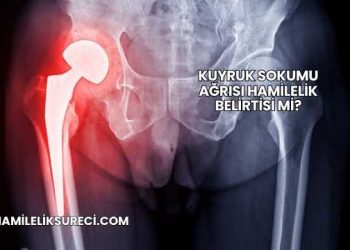 Kuyruk Sokumu Ağrısı Hamilelik Belirtisi mi?