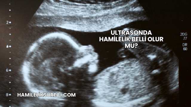 Ultrasonda Hamilelik Belli Olur mu?