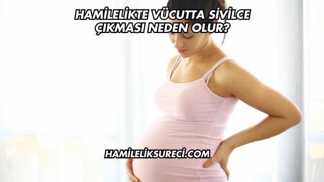 Hamilelikte Vücutta Sivilce Çıkması Neden Olur?