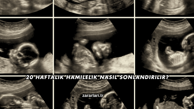 20 Haftalık Hamilelik Nasıl Sonlandırılır?