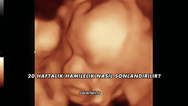 20 Haftalık Hamilelik Nasıl Sonlandırılır?