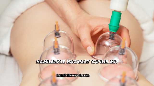 Hamilelikte Hacamat Yapılır mı?