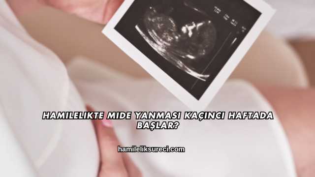 Hamilelikte Mide Yanması Kaçıncı Haftada Başlar?